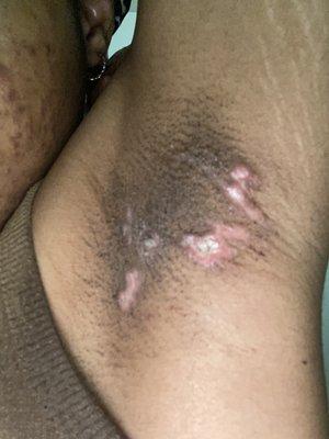 The Dermatology Specialists-Upper East Side