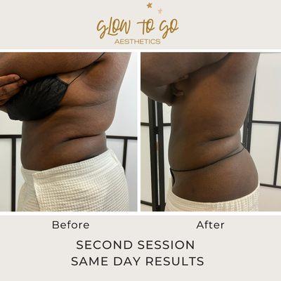 Glow To Go Aesthetics