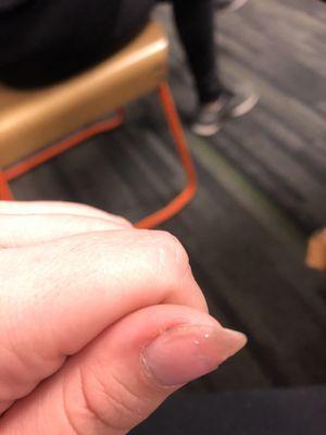 The gel top coat off the thumb nail