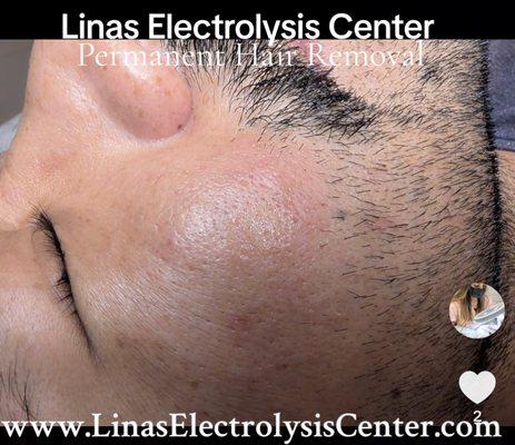 Lina's Electrolysis Center