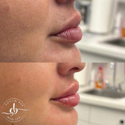 South Bay Med Spa - Whittier