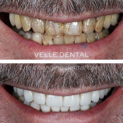 Velle Dental