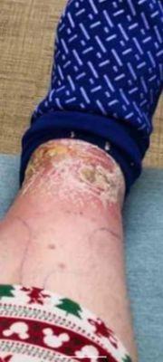 Mercy Hospital of Tiffin