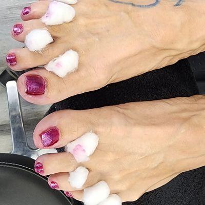 medical grade Pedicure