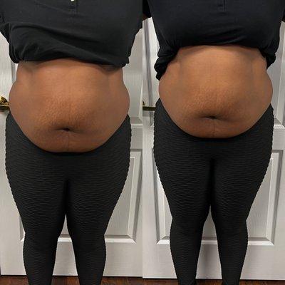 Lux Body&Esthetics Spa