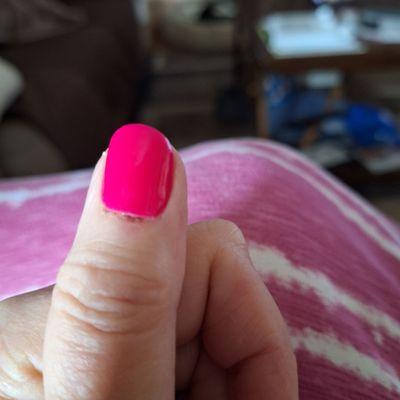 This is the worst of the 3, and this is 5 days later