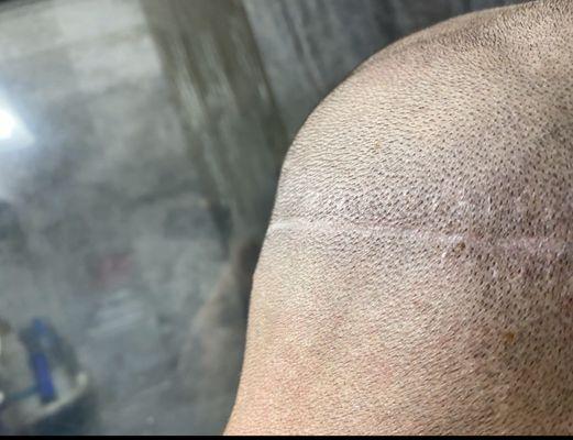 ForHair Hair Transplant Clinic