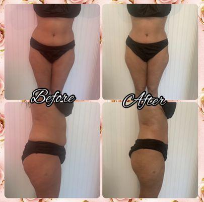 Sculpting her midsection