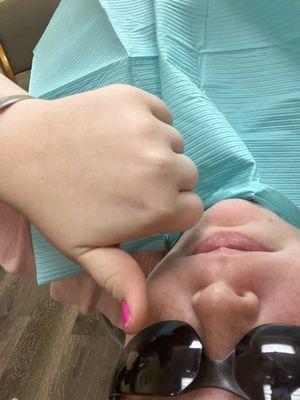 After my teeth clean!