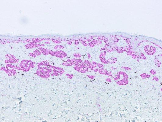 We have an extensive IHC and special stain menu