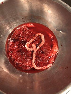 Placenta Services