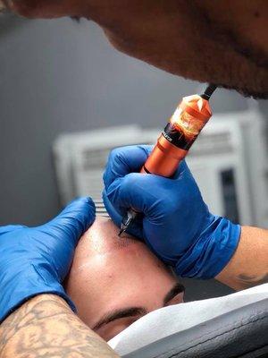 Tattooing a hair follicle to give you head a fuller look and bring your hairline back