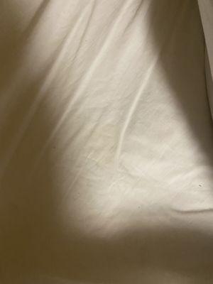 There is the pee stain on the sheet