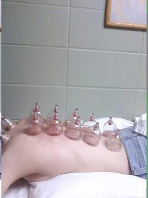 New Freedom Acupuncture