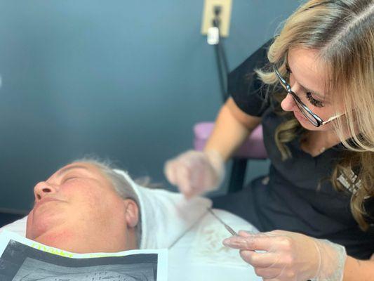 Dermaplaining Facial