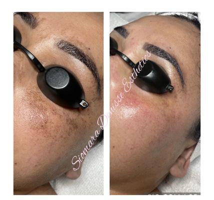 Siomara Denisse Esthetics