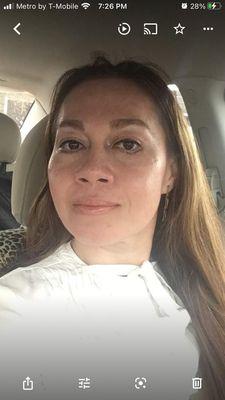 I don't recommend this place I spent $2000 and he He destroyed my life, he deformed my eye and my face. he was drunk, he was anxious.