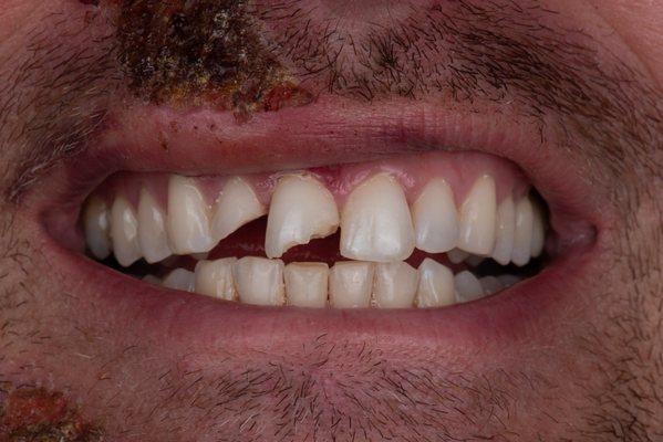 Blue Door Dental Design