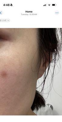 Laser Skin Care Solutions