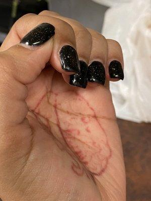 Chipped thumb finger with in 48 hrs of service