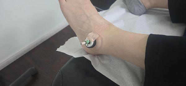 JI Acupuncture Clinic