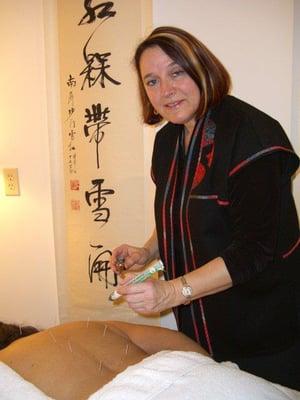 Barbara Paul - Acupuncture
