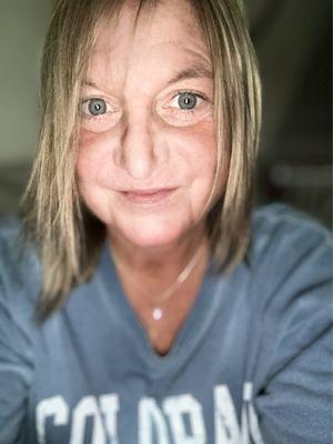 This is me, today (April 3, 2024). If this nose looks right to anyone, then please, hand over your cash to Dr. Costa.