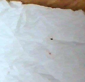 Bloody Bug that crawled out of my LEMON CHICKEN