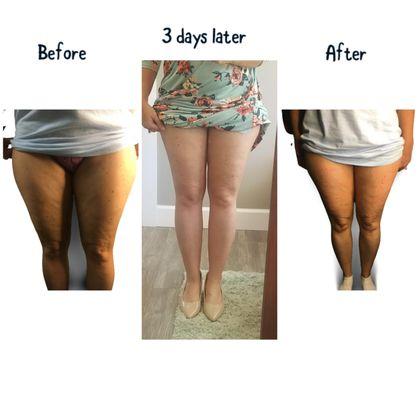 Lit Body Sculpting & Wellness