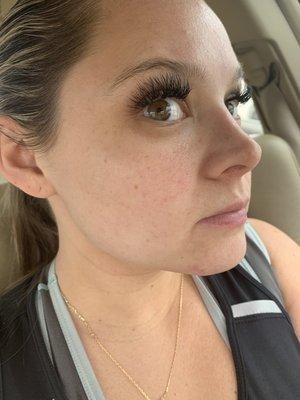 13 days AFTER facial and using the products I bought. Already such a difference!!