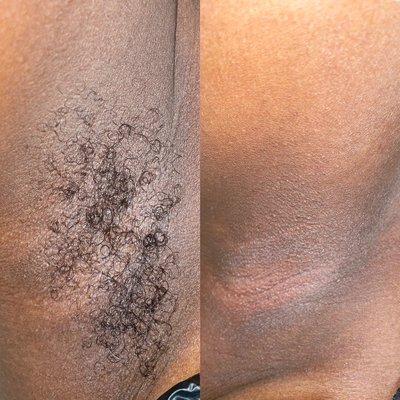 Blissful Skin Esthetics