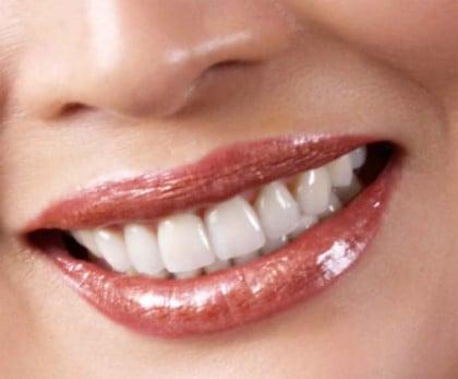 Call us for your free smile consultation right now. Crowns, Bridges, Veneers, Laminates, Pain free- Lumineers, Zoom whitening.