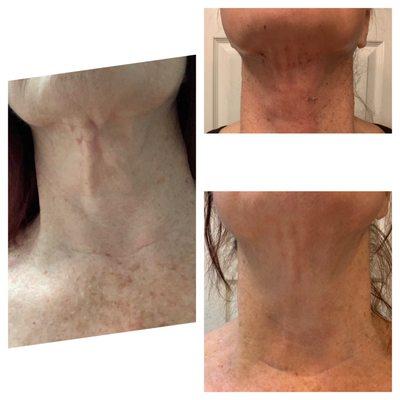 Timeless Body and Brows