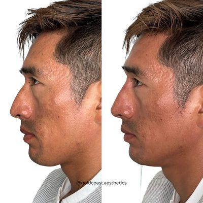 Gold Coast Aesthetics