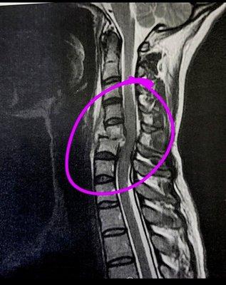 Gundersen Health System