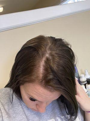 Lice Clinics of America - St. Charles