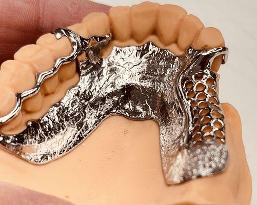 Metal frame custom design