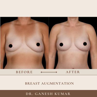 Illuminate Plastic Surgery