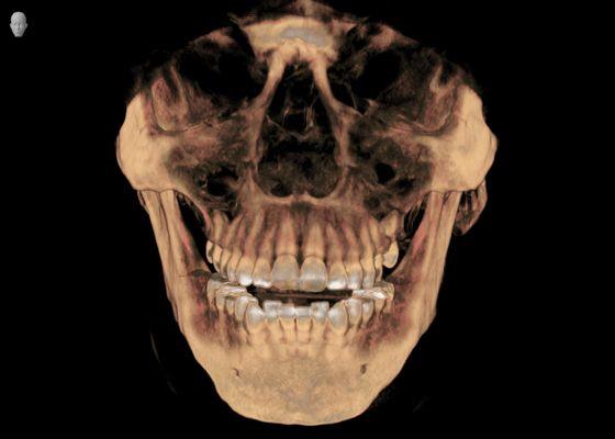 We offer 3D CBCT (Beam Computed Tomography), along with 2D records.