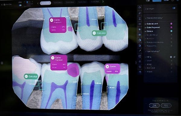 NEWET AI 2nd OPINION