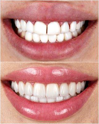 Joshua Ghiam, DDS - LA Smiles Dental Spa