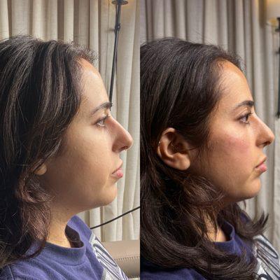 Nakedskin Aesthetics