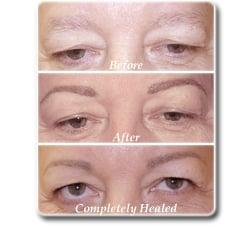 Skin Deep Permanent Cosmetics