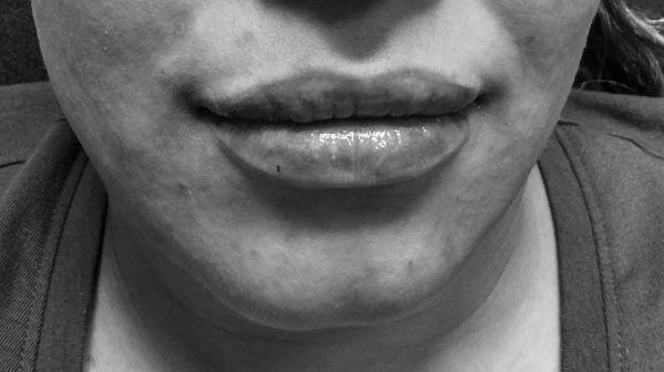 Belles Gens Laser & Spa