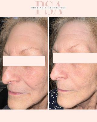 Pure Skin Aesthetics