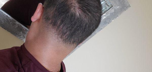 Wtf is this. A taper? Terrible cut!