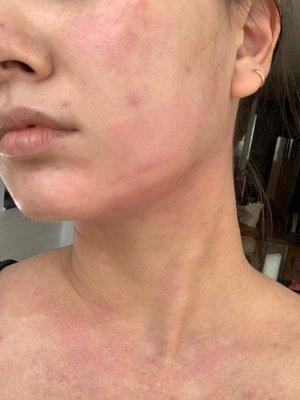 Skin Spa New York - Flatiron / Chelsea