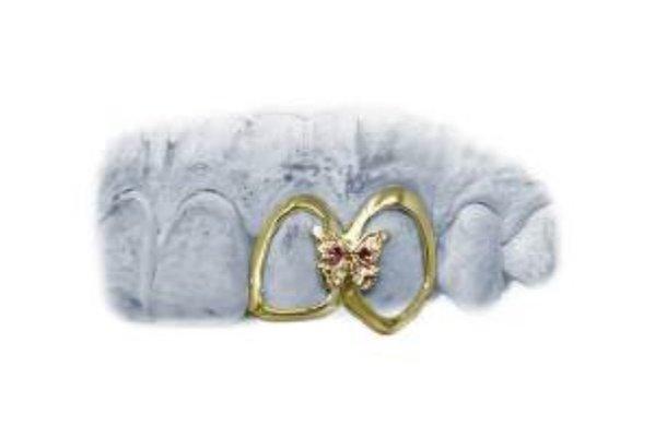 10k-22k Gold Removable Grill