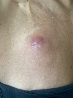 Maryland Hematology & Oncology