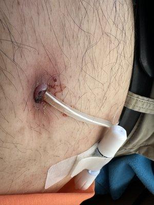 DaVita Indian River Dialysis Center